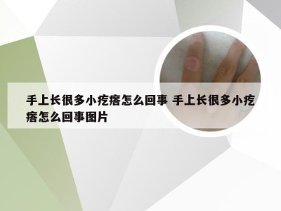 手上长很多小疙瘩怎么回事 手上长很多小疙瘩怎么回事图片