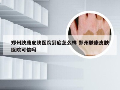 郑州肤康皮肤医院到底怎么样 郑州肤康皮肤医院可信吗