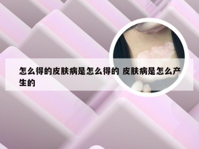 怎么得的皮肤病是怎么得的 皮肤病是怎么产生的