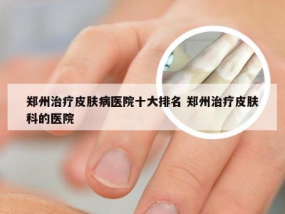 郑州治疗皮肤病医院十大排名 郑州治疗皮肤科的医院