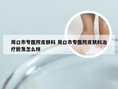 周口市专医院皮肤科 周口市专医院皮肤科治疗脱发怎么样