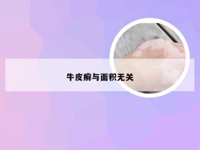 牛皮癣与面积无关