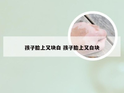 孩子脸上又块白 孩子脸上又白块