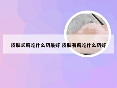 皮肤长癣吃什么药最好 皮肤有癣吃什么药好