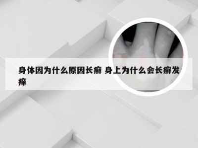 身体因为什么原因长癣 身上为什么会长癣发痒