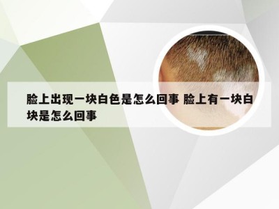 脸上出现一块白色是怎么回事 脸上有一块白块是怎么回事