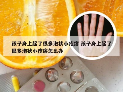 孩子身上起了很多泡状小疙瘩 孩子身上起了很多泡状小疙瘩怎么办