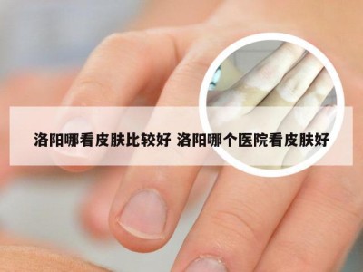 洛阳哪看皮肤比较好 洛阳哪个医院看皮肤好