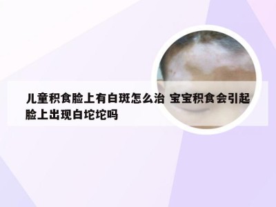 儿童积食脸上有白斑怎么治 宝宝积食会引起脸上出现白坨坨吗