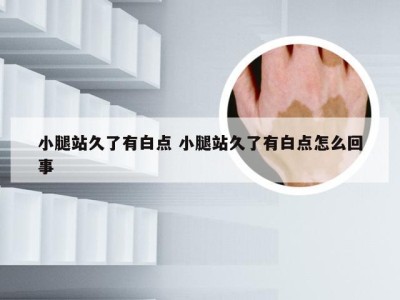 小腿站久了有白点 小腿站久了有白点怎么回事