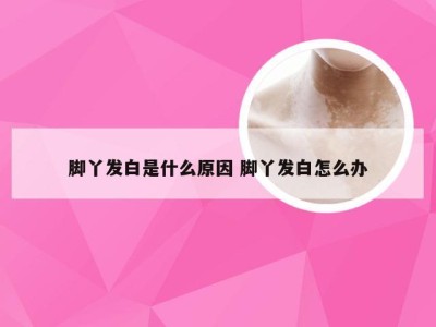 脚丫发白是什么原因 脚丫发白怎么办