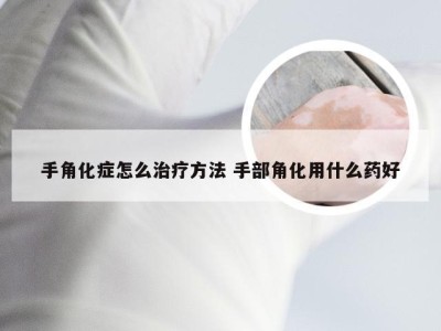 手角化症怎么治疗方法 手部角化用什么药好