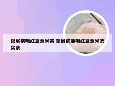 银屑病喝红豆薏米粥 银屑病能喝红豆薏米芡实茶