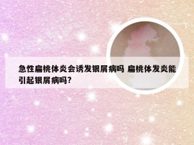 急性扁桃体炎会诱发银屑病吗 扁桃体发炎能引起银屑病吗?