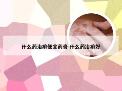 什么药治癣便宜药膏 什么药冶癣好