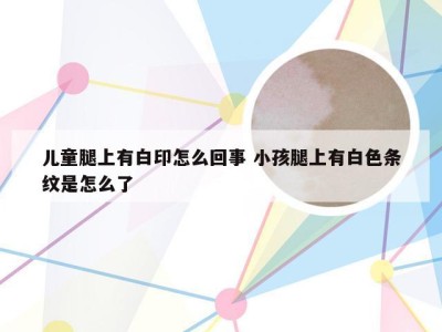 儿童腿上有白印怎么回事 小孩腿上有白色条纹是怎么了