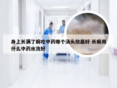 身上长满了癣吃中药哪个汤头放最好 长癣用什么中药水洗好