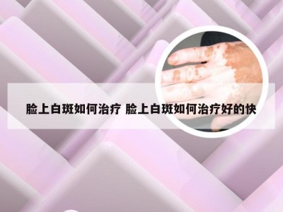 脸上白斑如何治疗 脸上白斑如何治疗好的快