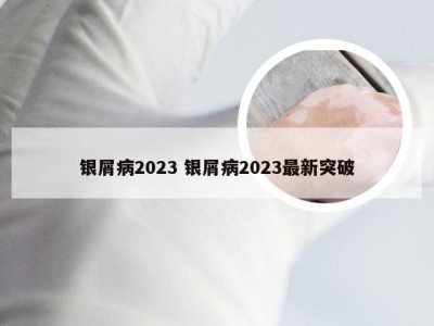 银屑病2023 银屑病2023最新突破