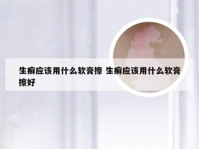 生癣应该用什么软膏擦 生癣应该用什么软膏擦好