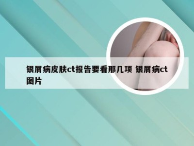 银屑病皮肤ct报告要看那几项 银屑病ct图片