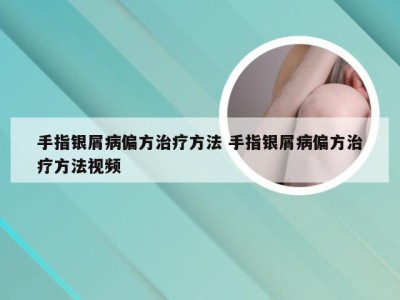 手指银屑病偏方治疗方法 手指银屑病偏方治疗方法视频