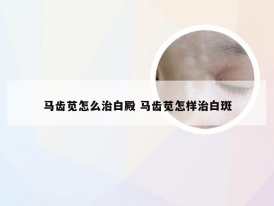 马齿苋怎么治白殿 马齿苋怎样治白斑