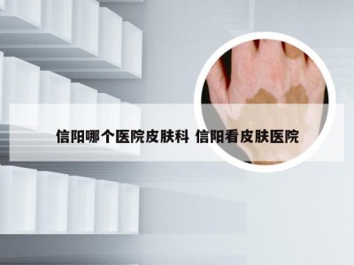 信阳哪个医院皮肤科 信阳看皮肤医院