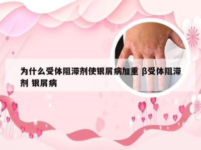 为什么受体阻滞剂使银屑病加重 β受体阻滞剂 银屑病