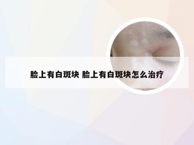 脸上有白斑块 脸上有白斑块怎么治疗