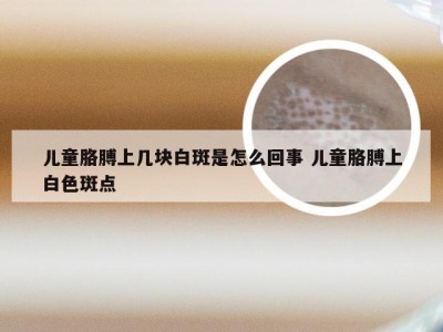 儿童胳膊上几块白斑是怎么回事 儿童胳膊上白色斑点