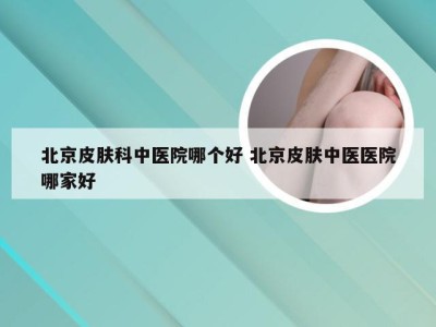 北京皮肤科中医院哪个好 北京皮肤中医医院哪家好