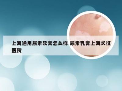 上海通用尿素软膏怎么样 尿素乳膏上海长征医院