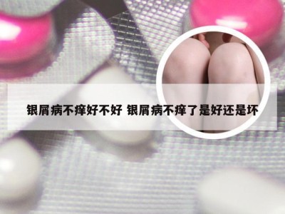 银屑病不痒好不好 银屑病不痒了是好还是坏