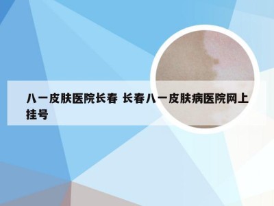 八一皮肤医院长春 长春八一皮肤病医院网上挂号