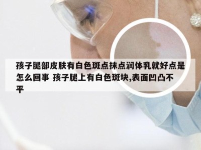 孩子腿部皮肤有白色斑点抹点润体乳就好点是怎么回事 孩子腿上有白色斑块,表面凹凸不平