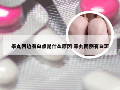 睾丸两边有白点是什么原因 睾丸两侧有白斑