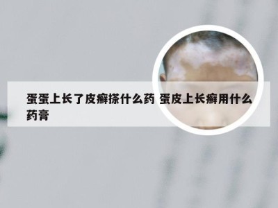 蛋蛋上长了皮癣搽什么药 蛋皮上长癣用什么药膏