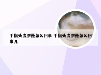 手指头流脓是怎么回事 手指头流脓是怎么回事儿