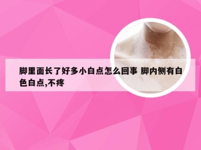 脚里面长了好多小白点怎么回事 脚内侧有白色白点,不疼