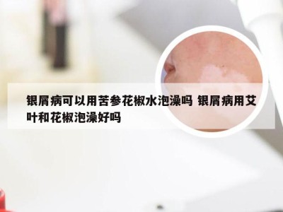 银屑病可以用苦参花椒水泡澡吗 银屑病用艾叶和花椒泡澡好吗