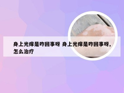 身上光痒是咋回事呀 身上光痒是咋回事呀,怎么治疗