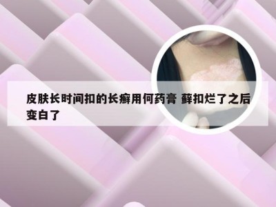 皮肤长时间扣的长癣用何药膏 藓扣烂了之后变白了