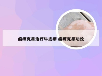 癣痒克星治疗牛皮癣 癣痒克星功效