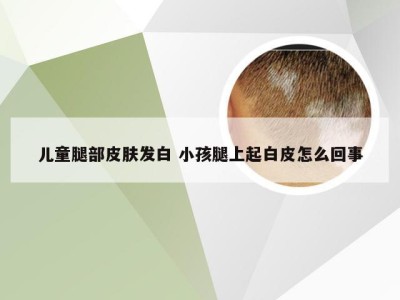 儿童腿部皮肤发白 小孩腿上起白皮怎么回事