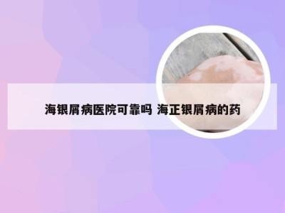 海银屑病医院可靠吗 海正银屑病的药