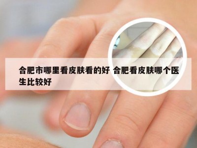 合肥市哪里看皮肤看的好 合肥看皮肤哪个医生比较好