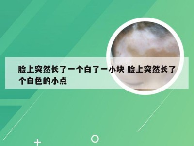 脸上突然长了一个白了一小块 脸上突然长了个白色的小点