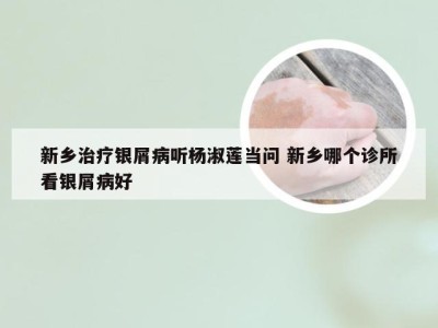 新乡治疗银屑病听杨淑莲当问 新乡哪个诊所看银屑病好