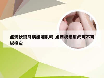 点滴状银屑病能哺乳吗 点滴状银屑病可不可以挠它